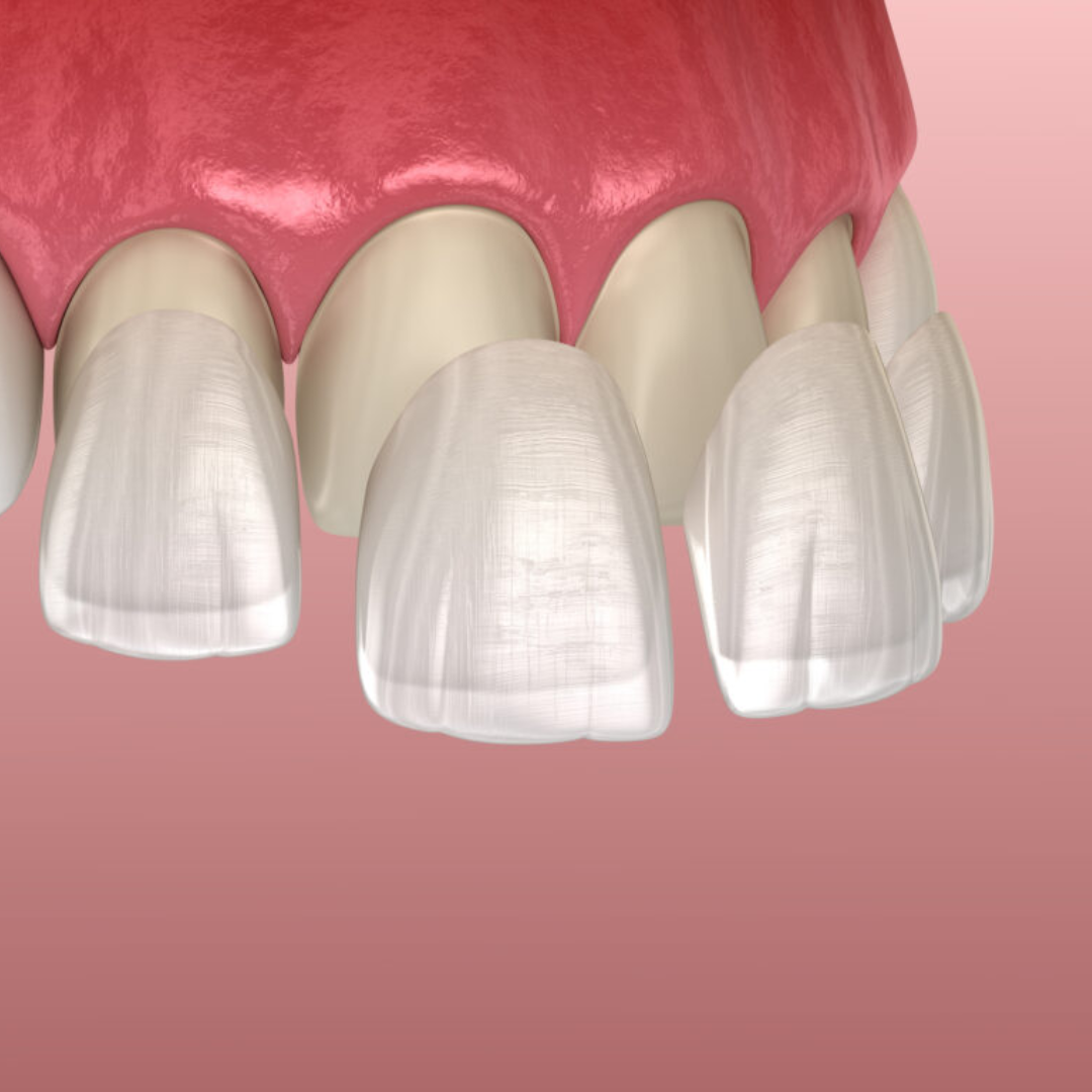 Design sem nome - 2022-08-03T204555.682