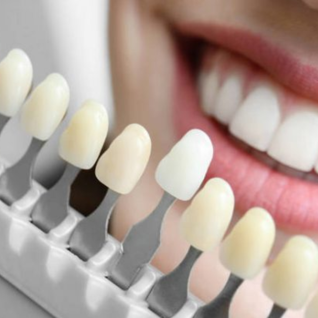 Design sem nome - 2022-08-03T204721.691