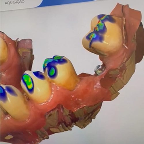 A qualidade e a precisão dos moldes é fundamental para o sucesso dos tratamentos
